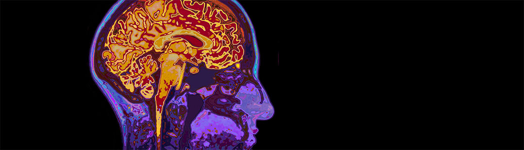 effetto wow - neurogadget Sercom